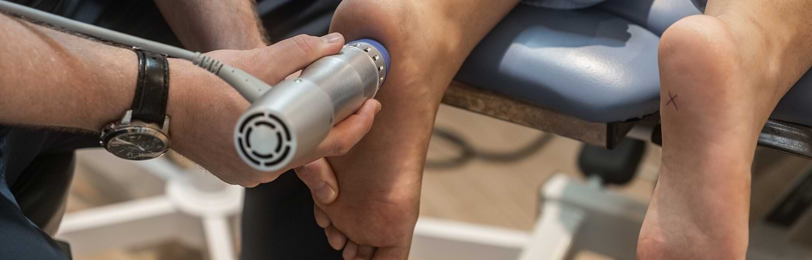 Shockwave Therapy for Plantar Fasciitis Treatment | Dundas University Health Clinic