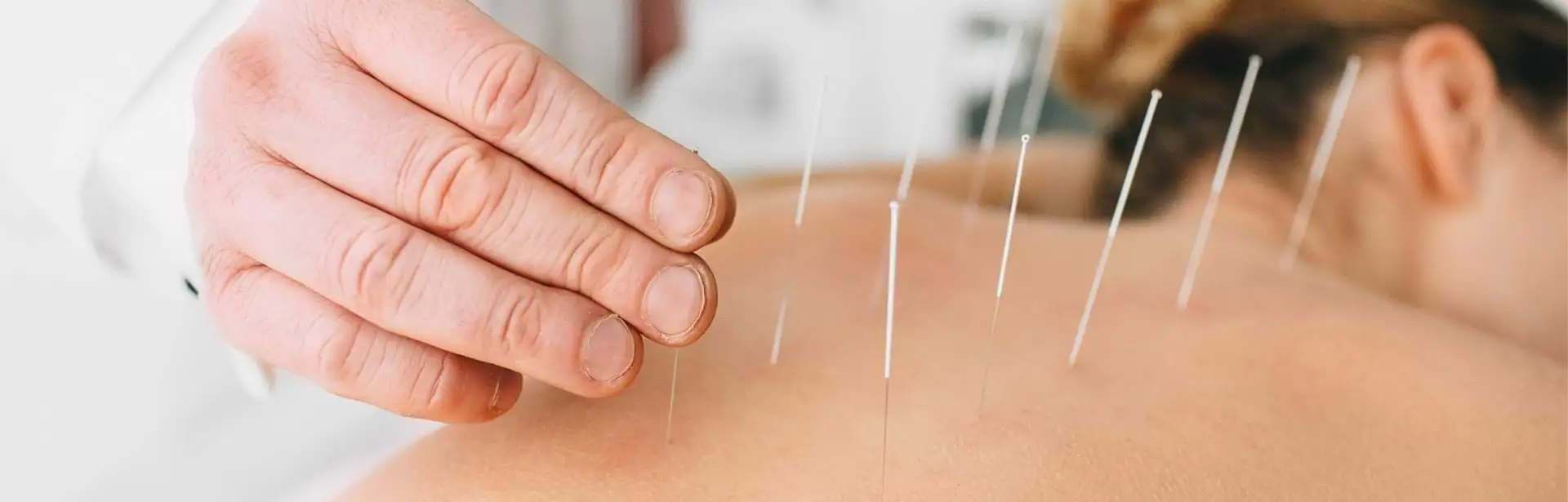Acupuncture Services Downtown Toronto | Dundas University Health Clinic