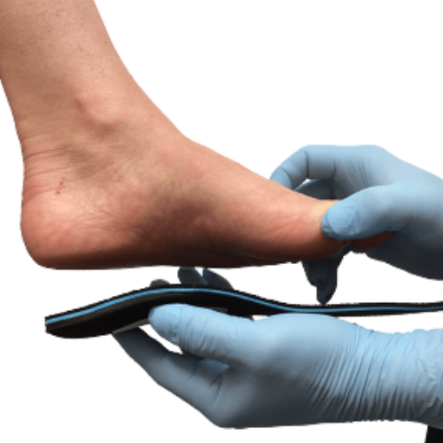Custom Made Foot Orthotics & Foot Inserts | Dundas University Health Clinic