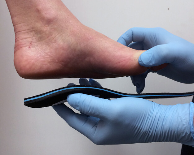 Custom Made Orthotics | Dundas University Health Clinic