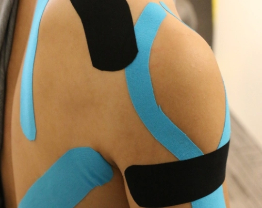 Kinesio Taping In Downtown Toronto| Dundas University Health Clinic