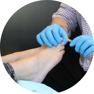 Foot Clinic Services| Dundas University Health Clinic