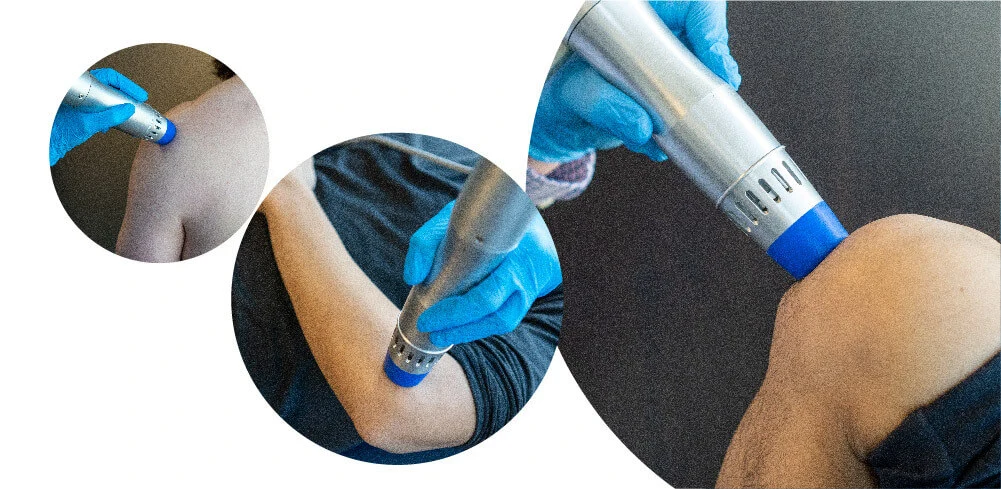 Radial-Shockwave-Therapy